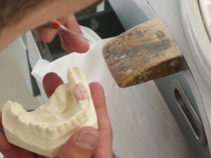 Protezy zębowe Gdańsk - czym są? - Amadent Blog